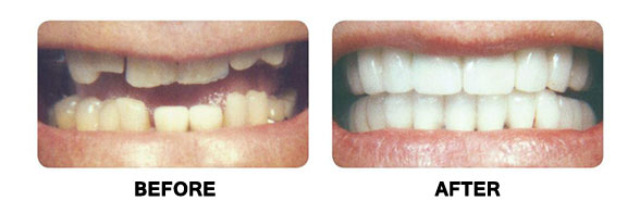 Cosmetic Dentistry by Dr. Anthony Mancino