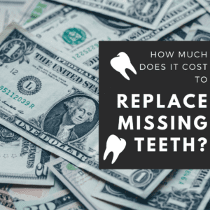 Cost to Replace Missing Teeth